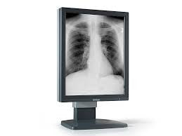 Barco Coronis 5 Megapixel Premium Diagnostic Grayscale Display - p/n K9300262A (No Power Supply)